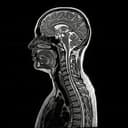 MRI