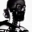 XRAY