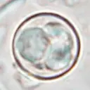 CYCLOSPORA