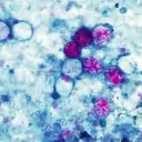 Cyclospora