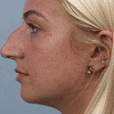 Nose