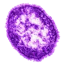 MeaslesVirus