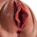 pus