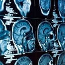 NeuroRes