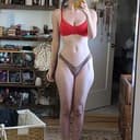 ANOREXIA