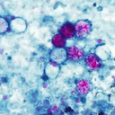 Cyclospora