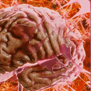 Organoid
