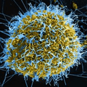 Ebola