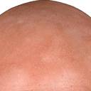 BALD