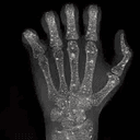 HAND