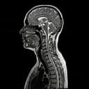 MRI