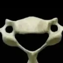 Vertebrae