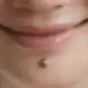 MOLE