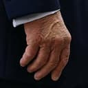 Hand
